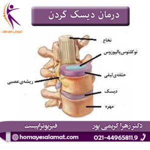 درمان-دیسک-گردن-23